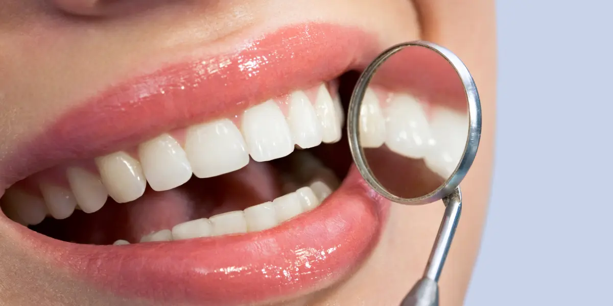 Coloquei lentes de contato dental e me arrependi